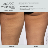 ageLOC WellSpa iO + Activating Gel