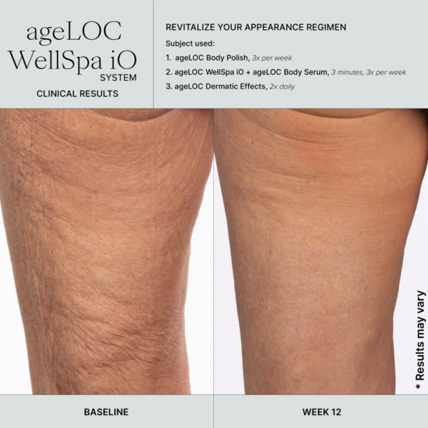 ageLOC WellSpa iO + Activating Gel