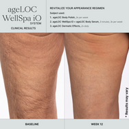 ageLOC WellSpa iO + Activating Gel